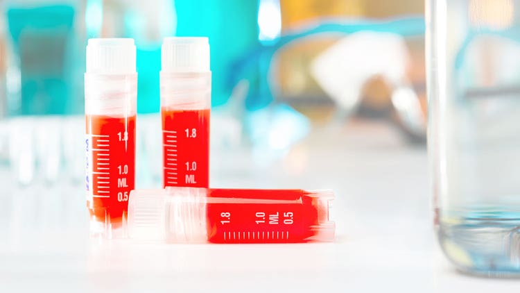 Antibodies and Immunoglobulins