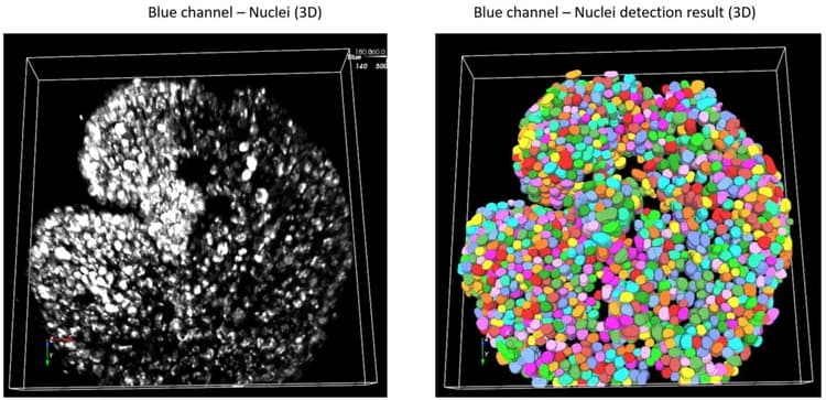 Csm_AIVIA 3D_intestinal_organoid_05b0f03d84
