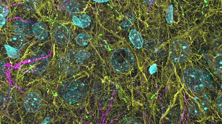 Csm_3D THUNDERed Spinning Disk Image Of Mouse Brain_a6ae2bf9d8