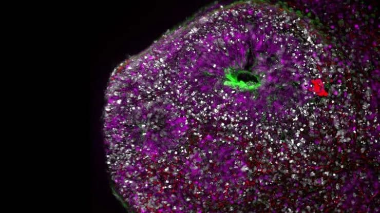 Csm_Snap_THUNDER_Imager_3D_Cell_Culture_HumBrainOrganoid_b9d3c64140