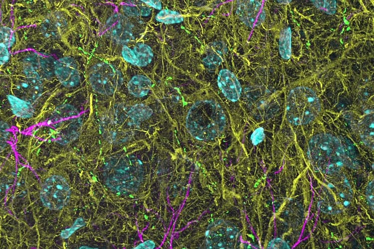 Csm_3D THUNDERed Spinning Disk Image Of Mouse Brain_e52c80e875