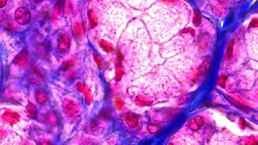 Csm_Parotid_gland_12_bit_ffd6050552
