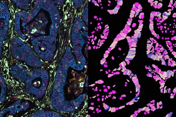 Csm_48 Channel Human Colon Channel CellDive AI_ea9c7033ae