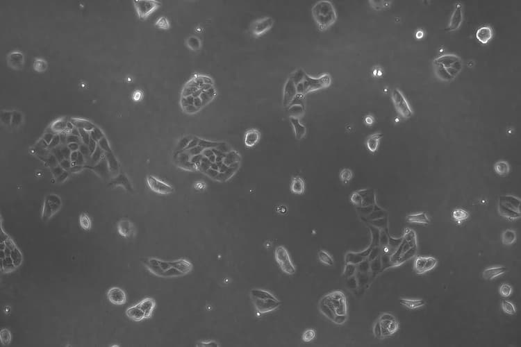 Csm_lmd Hela Cells_05_2990f0caa0