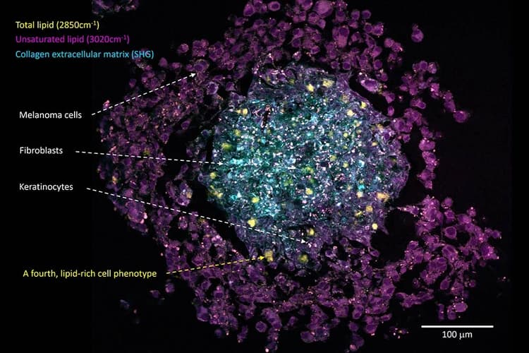 Cancer Spheroid_02