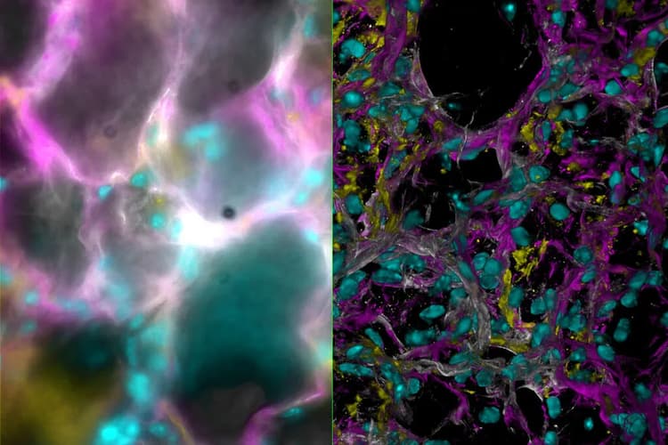 Csm_Mouse Lung Tissue Stained For A Study Of Type I Alveolar Epithelial Cell AT1 Biology_3c39c6f23a